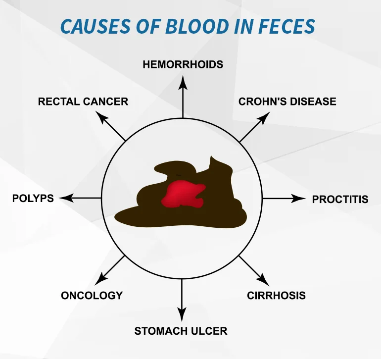 blood-in-stool-causes