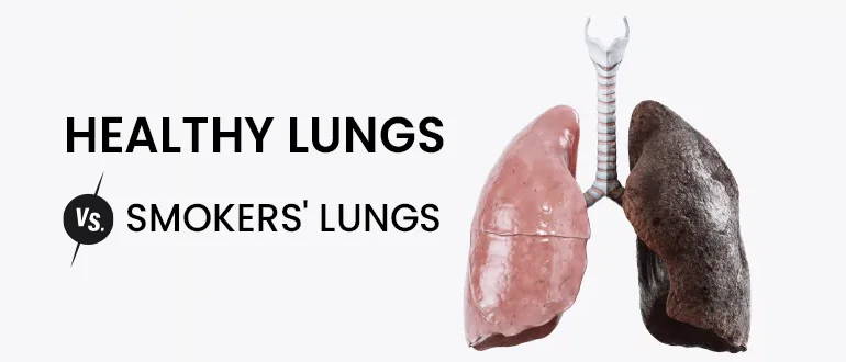 Smokers’ Lungs Vs. Healthy Lungs Smokers’ Lungs Vs. Healthy Lungs